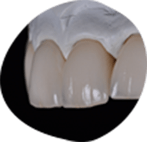 低価格/高品質の歯