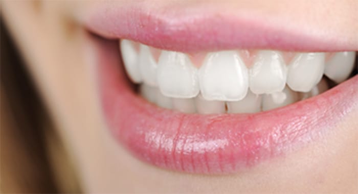 白い歯・セラミック治療